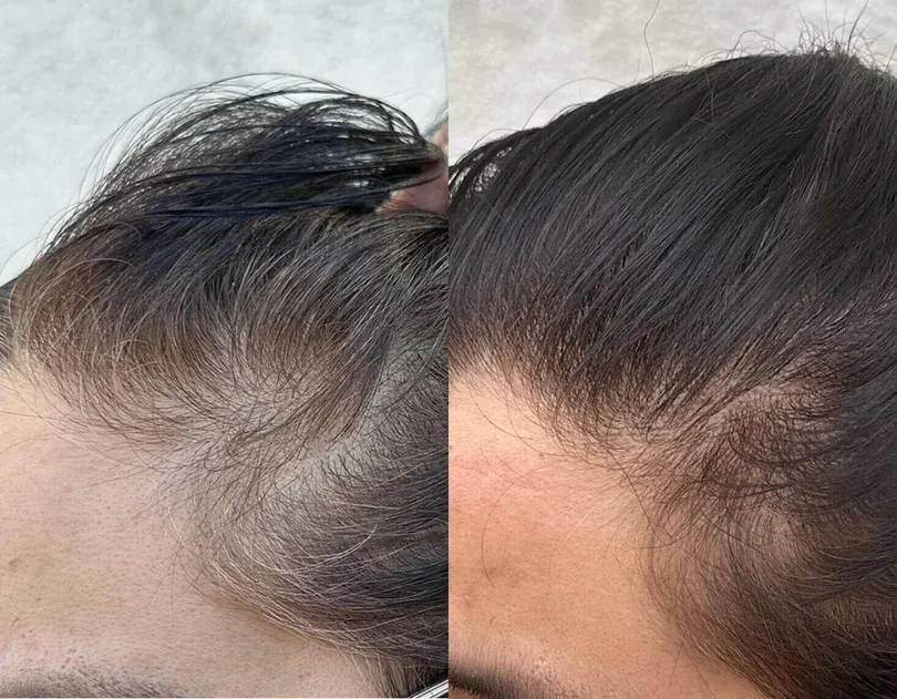 Week 1 and week 12 comparison