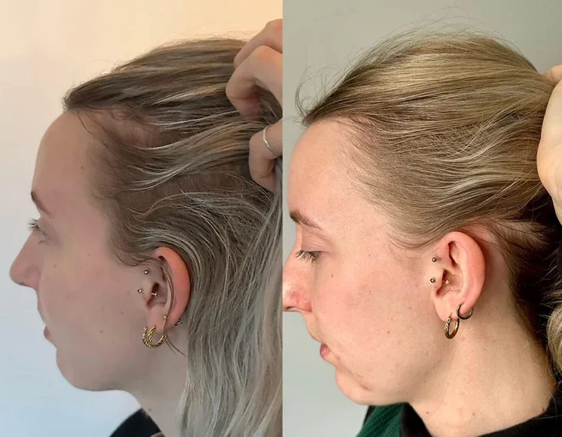 Week 1 and week 12 comparison