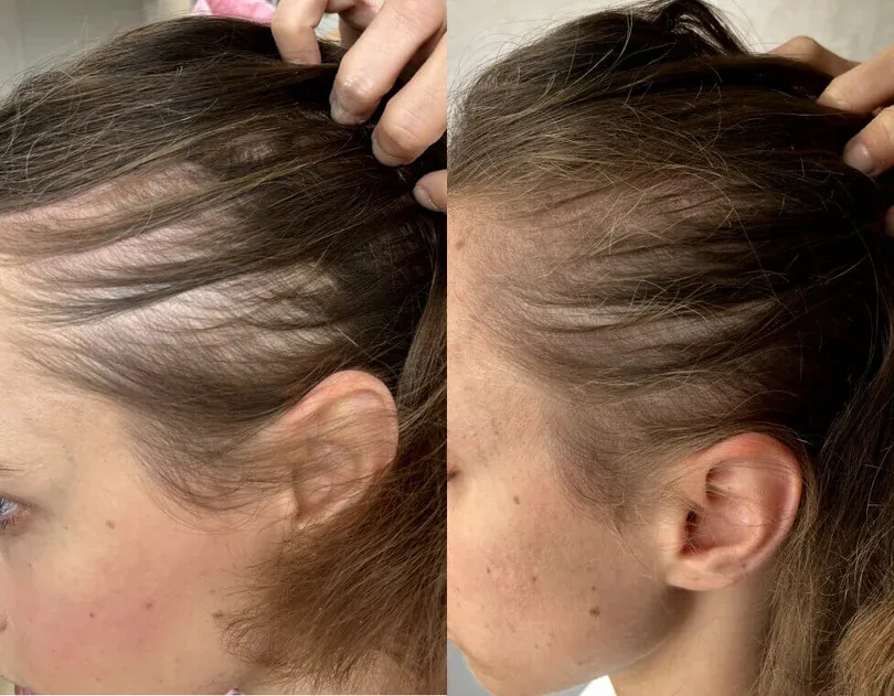 Week 1 and week 12 comparison