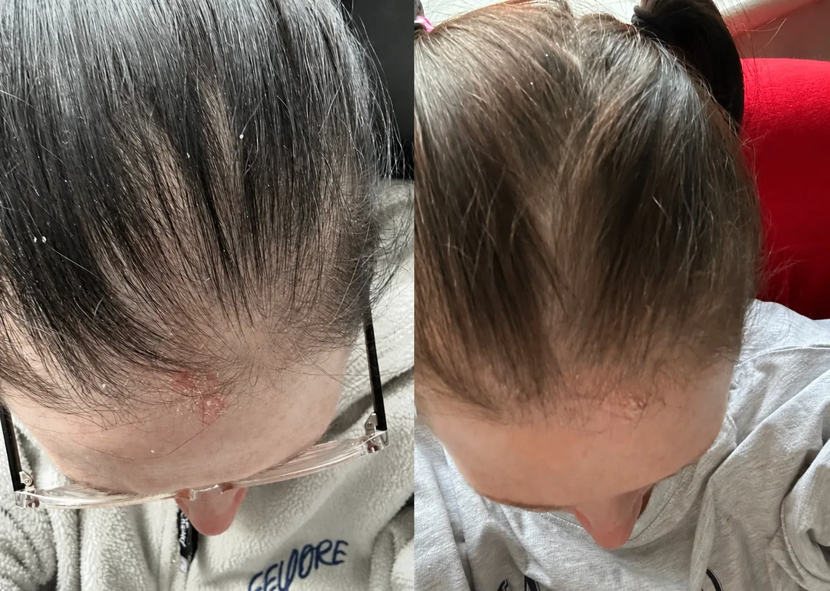 Week 1 and week 12 comparison