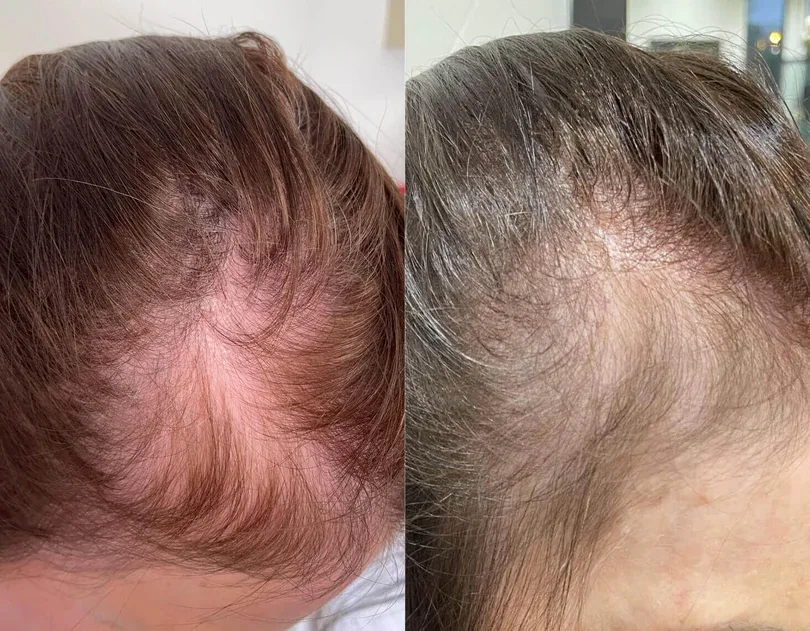Week 1 and week 12 comparison