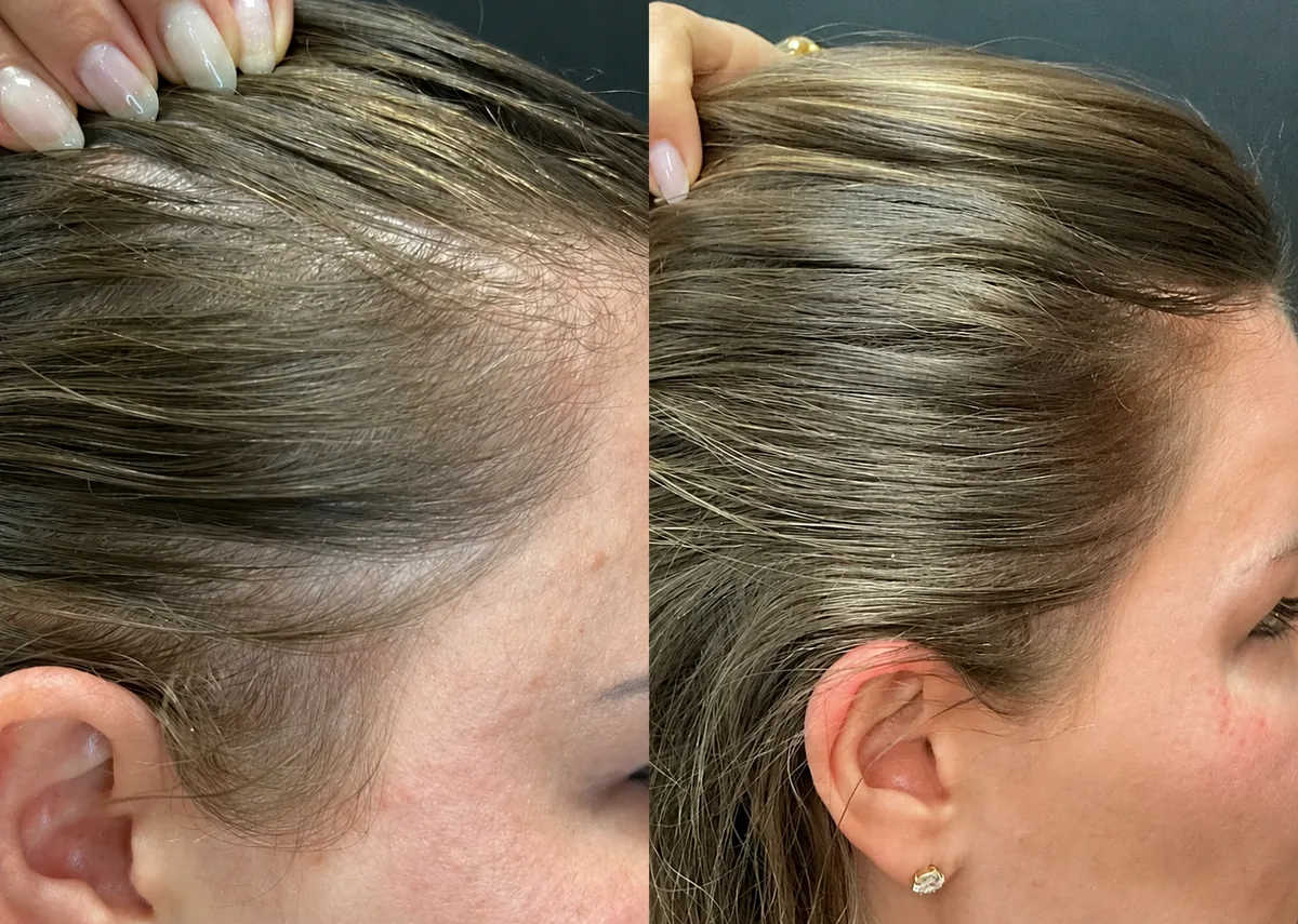 Week 1 and week 12 comparison