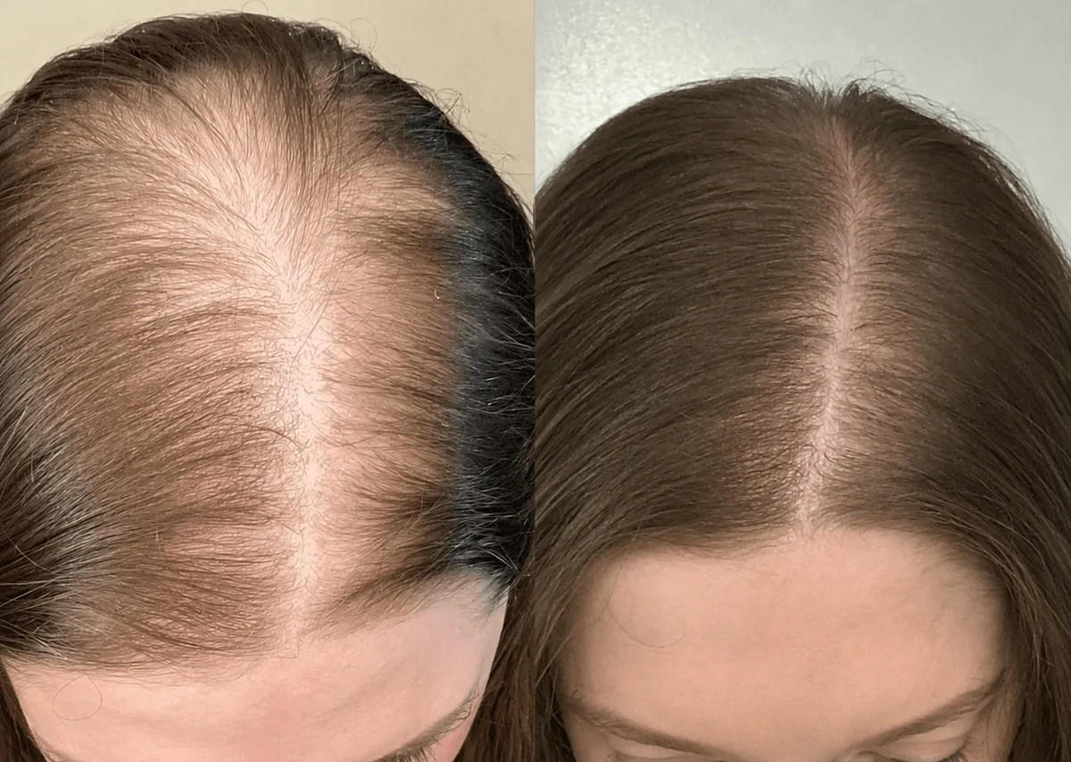 Week 1 and week 12 comparison