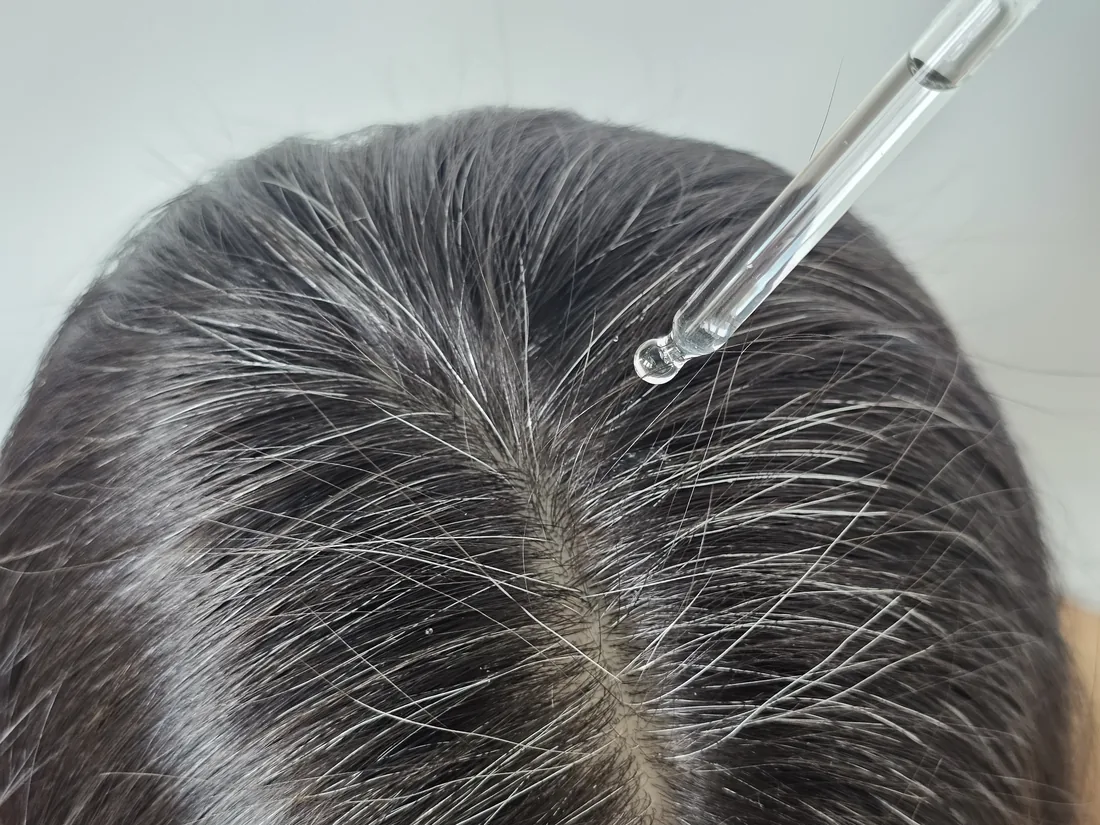 Applying Crowned® serum along the scalp with the dropper